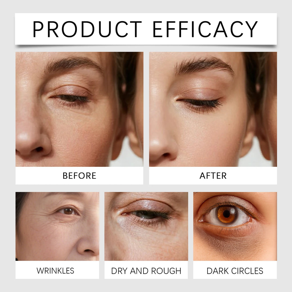 Temporary Tighten Eye Cream for Removal Eye Bags Anti Puffiness Dark Circles Removal Firming Increase Elasticity Massage EyeCare